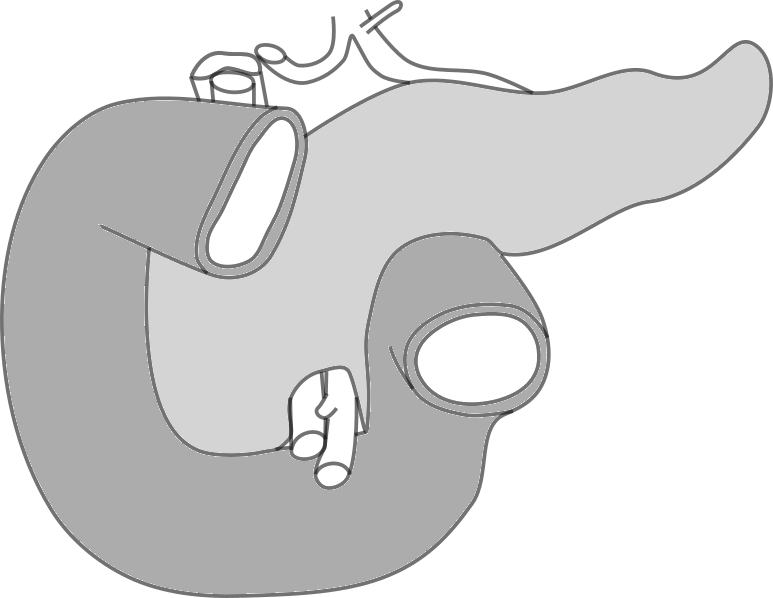 Hepatobiliyerpankreatik Cerrahi